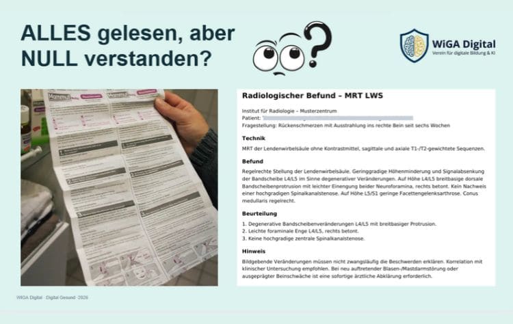 Präsentationsfolie des WIGA Digital Workshops „Digital gesund – KI im Gesundheitsalltag“ mit der Überschrift „ALLES gelesen, aber NULL verstanden?“. Links ist ein schwer verständlicher Medikamentenbeipackzettel zu sehen, rechts ein medizinischer MRT-Befund der Lendenwirbelsäule mit Fachbegriffen. Die Folie verdeutlicht, wie schwierig medizinische Informationen sein können und wie künstliche Intelligenz beim besseren Verständnis helfen kann.
